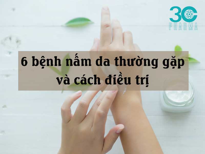 6 bệnh nấm da thường gặp và cách điều trị
