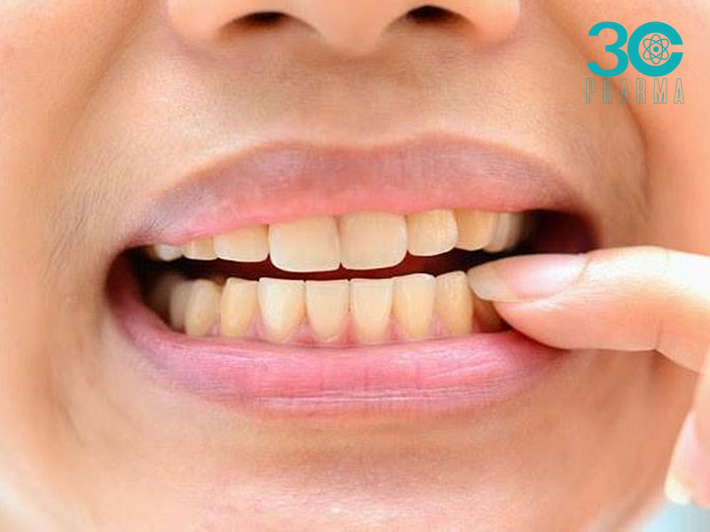 Nguyên nhân răng ố vàng và cách chữa trị